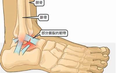 脚踝是哪里(脚踝是哪个位置)