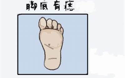 脚底有痣的男人(男人脚底有痣代表什么意思)